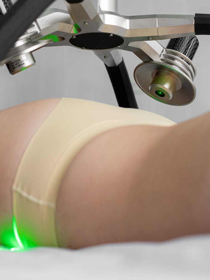 Close-up of a laser machine performing body sculpting on a womans hip area, emphasizing wellness and technology.